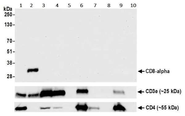 Western blot - Anti-CD8 alpha antibody [BLR044F] (AB243900)