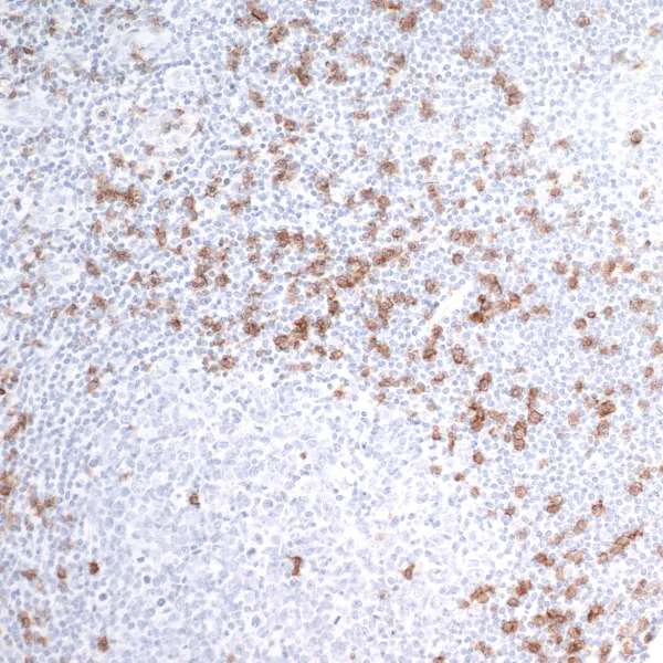 Immunohistochemistry (Formalin/PFA-fixed paraffin-embedded sections) - Anti-CD8 alpha antibody [BLR044F] - BSA free (AB272093)