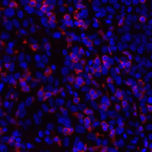 Immunohistochemistry (Formalin/PFA-fixed paraffin-embedded sections) - Anti-CD8 alpha antibody [BLR044F] - BSA free (AB272093)