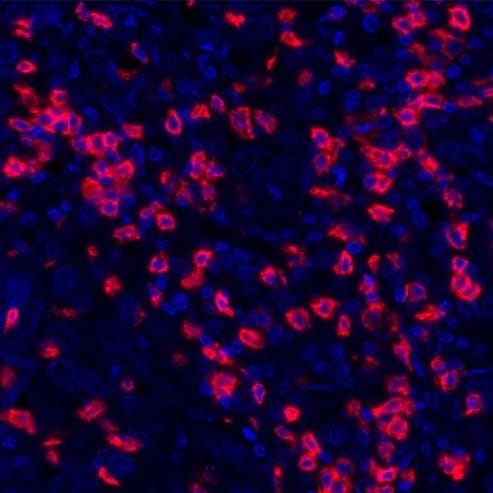 Immunohistochemistry (Formalin/PFA-fixed paraffin-embedded sections) - Anti-CD8 alpha antibody [BLR044F] - BSA free (AB272093)