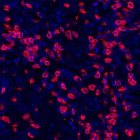 Immunohistochemistry (Formalin/PFA-fixed paraffin-embedded sections) - Anti-CD8 alpha antibody [BLR044F] - BSA free (AB272093)