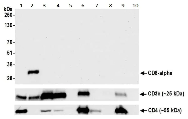 Western blot - Anti-CD8 alpha antibody [BLR044F] - BSA free (AB272093)