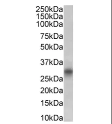Western blot - Anti-CD8 alpha Antibody [Bu88] (AB316355)
