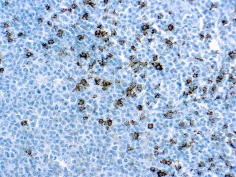 Immunohistochemistry (Formalin/PFA-fixed paraffin-embedded sections) - Anti-CD8 alpha antibody [C8/144B] (AB17147)