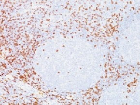 Immunohistochemistry (Formalin/PFA-fixed paraffin-embedded sections) - Anti-CD8 alpha antibody [C8/468] (AB233995), expandable thumbnail