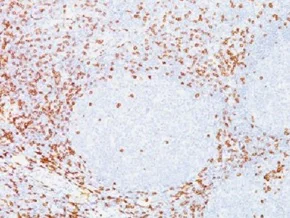 Immunohistochemistry (Formalin/PFA-fixed paraffin-embedded sections) - Anti-CD8 alpha antibody [C8/468] - BSA and Azide free (AB213017)