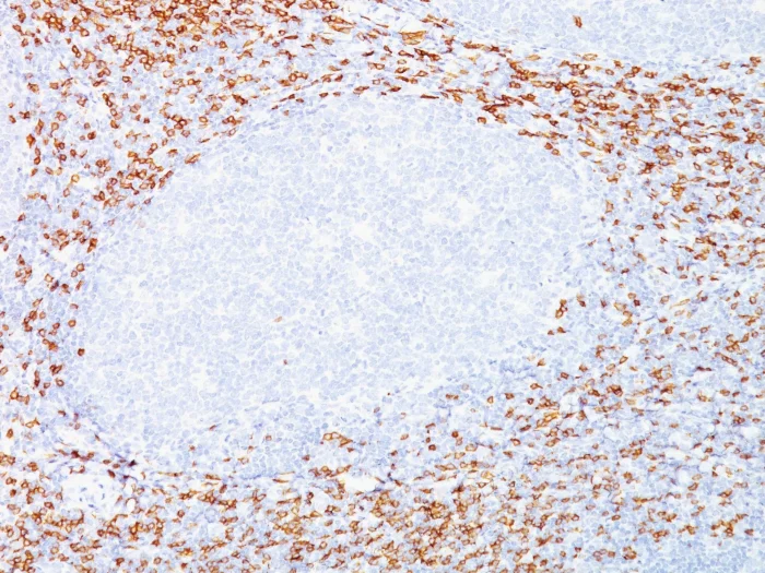 Immunohistochemistry (Formalin/PFA-fixed paraffin-embedded sections) - Anti-CD8 alpha antibody [C8/468 + C8/144B] (AB199016)