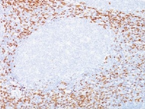 Immunohistochemistry (Formalin/PFA-fixed paraffin-embedded sections) - Anti-CD8 alpha antibody [C8/468 + C8/144B] - BSA and Azide free (AB213020), expandable thumbnail
