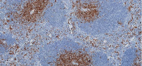 Immunohistochemistry (Formalin/PFA-fixed paraffin-embedded sections) - Anti-CD8 alpha antibody [CAL38] (AB237723)