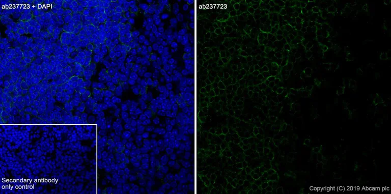 Immunohistochemistry (Frozen sections) - Anti-CD8 alpha antibody [CAL38] - BSA and Azide free (AB251609)