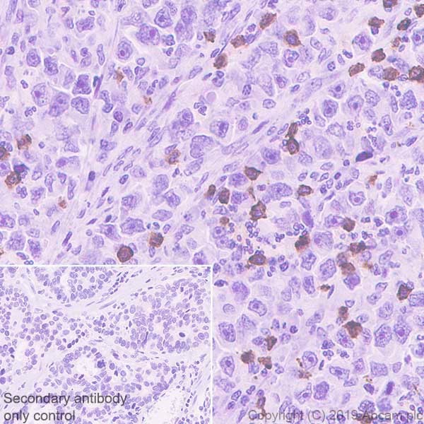 Immunohistochemistry (Formalin/PFA-fixed paraffin-embedded sections) - Anti-CD8 alpha antibody [CAL66] (AB237709), expandable thumbnail