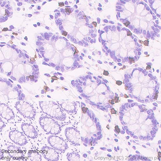 Immunohistochemistry (Formalin/PFA-fixed paraffin-embedded sections) - Anti-CD8 alpha antibody [CAL66] (AB237709), expandable thumbnail