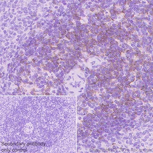 Immunohistochemistry (Formalin/PFA-fixed paraffin-embedded sections) - Anti-CD8 alpha antibody [CAL66] (AB237709)