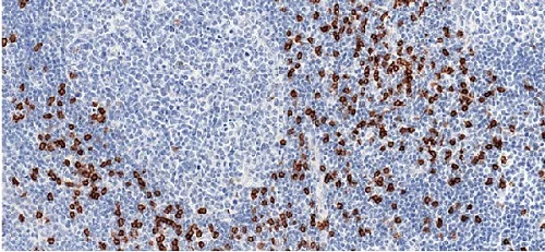 Immunohistochemistry (Formalin/PFA-fixed paraffin-embedded sections) - Anti-CD8 alpha antibody [CAL66] - BSA and Azide free (AB251596)