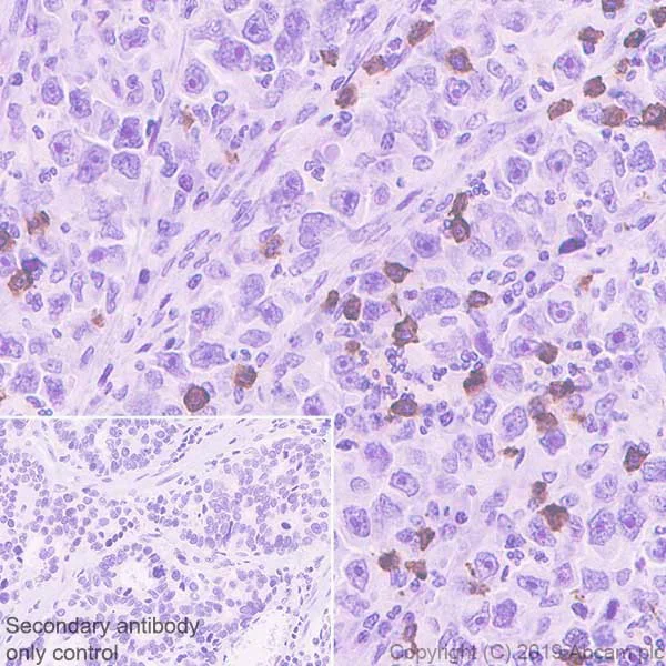 Immunohistochemistry (Formalin/PFA-fixed paraffin-embedded sections) - Anti-CD8 alpha antibody [CAL66] - BSA and Azide free (AB251596)