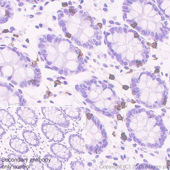 Immunohistochemistry (Formalin/PFA-fixed paraffin-embedded sections) - Anti-CD8 alpha antibody [CAL66] - BSA and Azide free (AB251596)