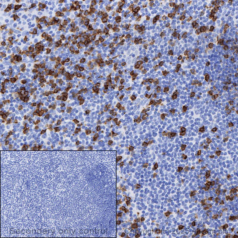 Immunohistochemistry (Formalin/PFA-fixed paraffin-embedded sections) - Anti-CD8 alpha antibody [CAL66] - BSA and Azide free (AB251596)