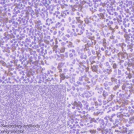 Immunohistochemistry (Formalin/PFA-fixed paraffin-embedded sections) - Anti-CD8 alpha antibody [CAL66] - BSA and Azide free (AB251596)