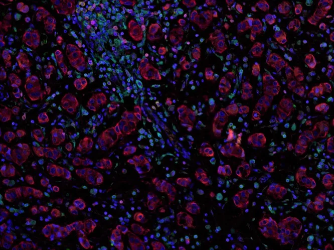 Multiplex immunohistochemistry - Anti-CD8 alpha antibody [CAL66] - BSA and Azide free (AB251596)