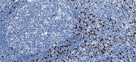 Immunohistochemistry (Formalin/PFA-fixed paraffin-embedded sections) - Anti-CD8 alpha antibody [CAL67] (AB237710)