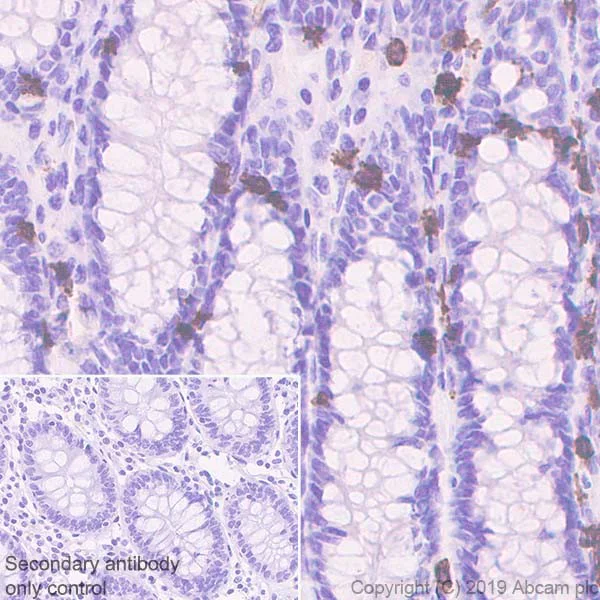 Immunohistochemistry (Formalin/PFA-fixed paraffin-embedded sections) - Anti-CD8 alpha antibody [CAL67] (AB237710)