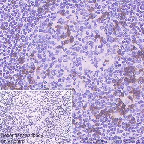 Immunohistochemistry (Formalin/PFA-fixed paraffin-embedded sections) - Anti-CD8 alpha antibody [CAL67] - BSA and Azide free (AB251597)