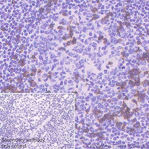 Immunohistochemistry (Formalin/PFA-fixed paraffin-embedded sections) - Anti-CD8 alpha antibody [CAL67] - BSA and Azide free (AB251597)