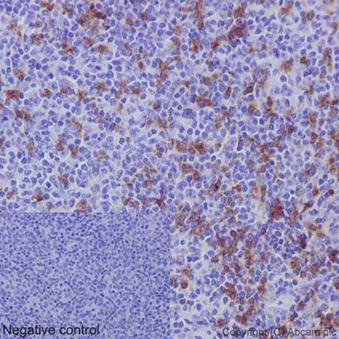 Immunohistochemistry (Formalin/PFA-fixed paraffin-embedded sections) - Anti-CD8 alpha antibody [EPR10640(2)] - N-terminal (AB189926)