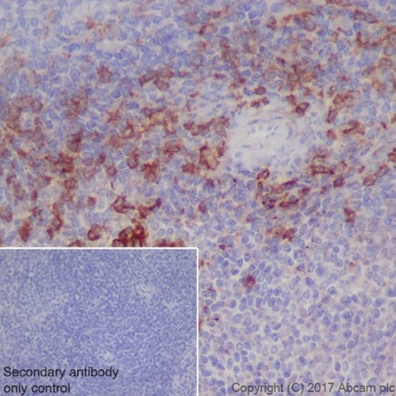 Immunohistochemistry (Formalin/PFA-fixed paraffin-embedded sections) - Anti-CD8 alpha antibody [EPR20305] (AB209775), expandable thumbnail
