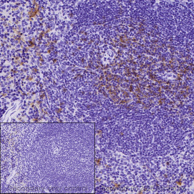 Immunohistochemistry (Formalin/PFA-fixed paraffin-embedded sections) - Anti-CD8 alpha antibody [EPR20305] (AB209775)