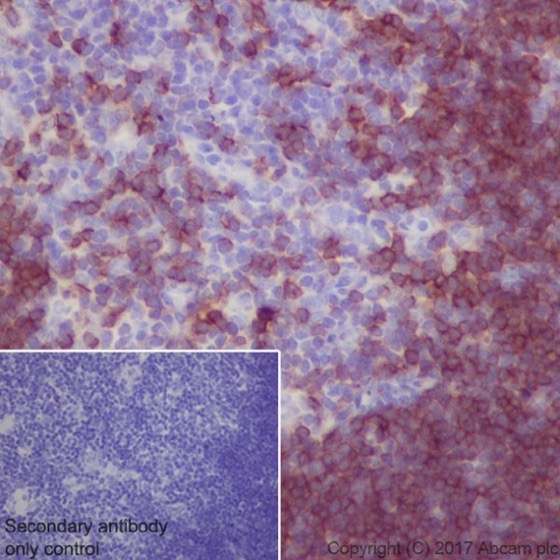 Immunohistochemistry (Formalin/PFA-fixed paraffin-embedded sections) - Anti-CD8 alpha antibody [EPR20305] (AB209775), expandable thumbnail