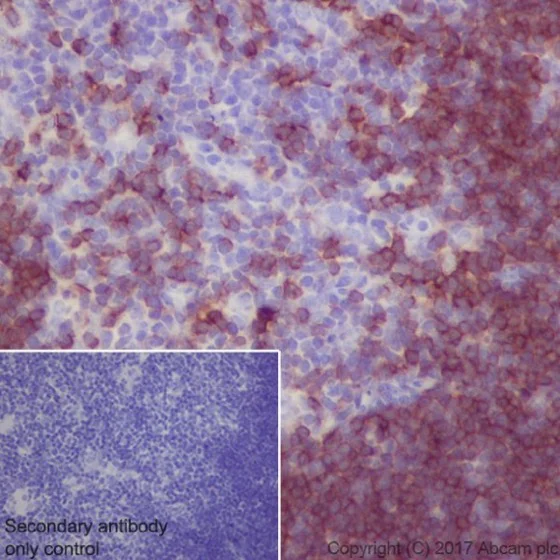 Immunohistochemistry (Formalin/PFA-fixed paraffin-embedded sections) - Anti-CD8 alpha antibody [EPR20305] (AB209775)