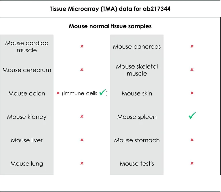 Immunohistochemistry (Formalin/PFA-fixed paraffin-embedded sections) - Anti-CD8 alpha antibody [EPR21769] (AB217344)