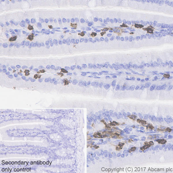 Immunohistochemistry (Formalin/PFA-fixed paraffin-embedded sections) - Anti-CD8 alpha antibody [EPR21769] - BSA and Azide free (ab230156), expandable thumbnail