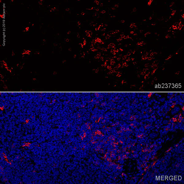 Immunohistochemistry (Formalin/PFA-fixed paraffin-embedded sections) - Anti-CD8 alpha antibody [EPR21769] - BSA and Azide free (AB230156)