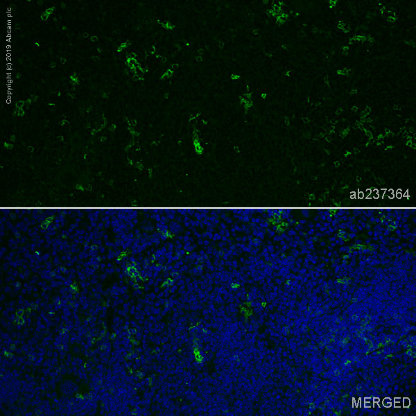 Immunohistochemistry (Formalin/PFA-fixed paraffin-embedded sections) - Anti-CD8 alpha antibody [EPR21769] - BSA and Azide free (AB230156), expandable thumbnail