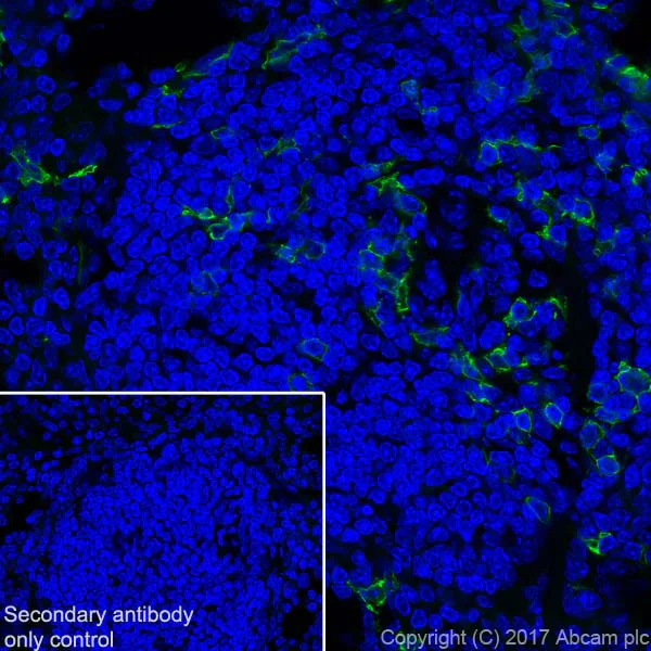 Immunohistochemistry (Frozen sections) - Anti-CD8 alpha antibody [EPR21769] - BSA and Azide free (AB230156)
