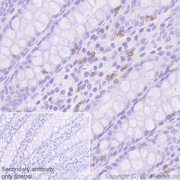 Immunohistochemistry (Formalin/PFA-fixed paraffin-embedded sections) - Anti-CD8 alpha antibody [EPR22483-288] - BSA and Azide free (AB245830), expandable thumbnail
