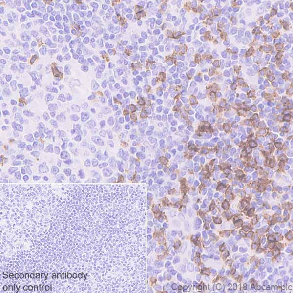 Immunohistochemistry (Formalin/PFA-fixed paraffin-embedded sections) - Anti-CD8 alpha antibody [EPR22483-288] - BSA and Azide free (AB245830), expandable thumbnail