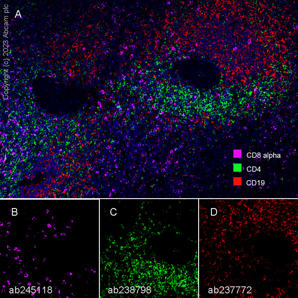 Multiplex immunohistochemistry - Anti-CD8 alpha antibody [EPR22483-288] - BSA and Azide free (ab245830), expandable thumbnail