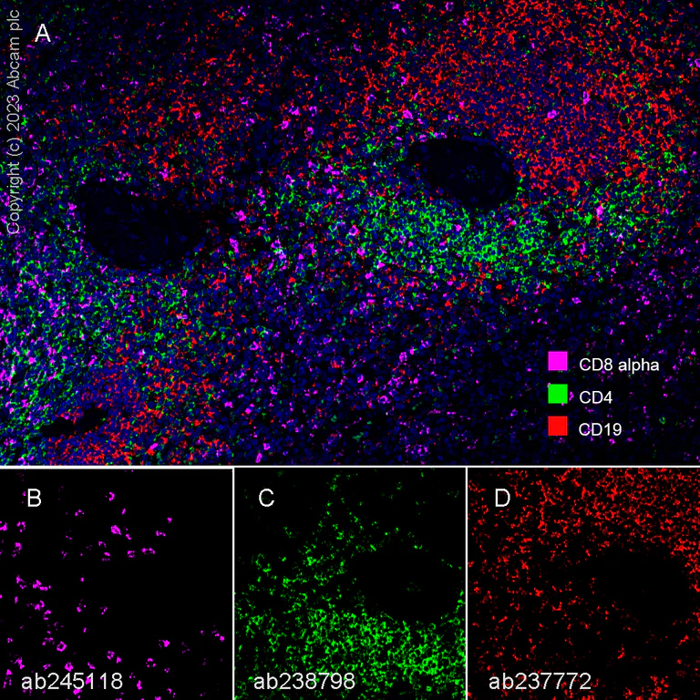 Multiplex immunohistochemistry - Anti-CD8 alpha antibody [EPR22483-288] - BSA and Azide free (AB245830)