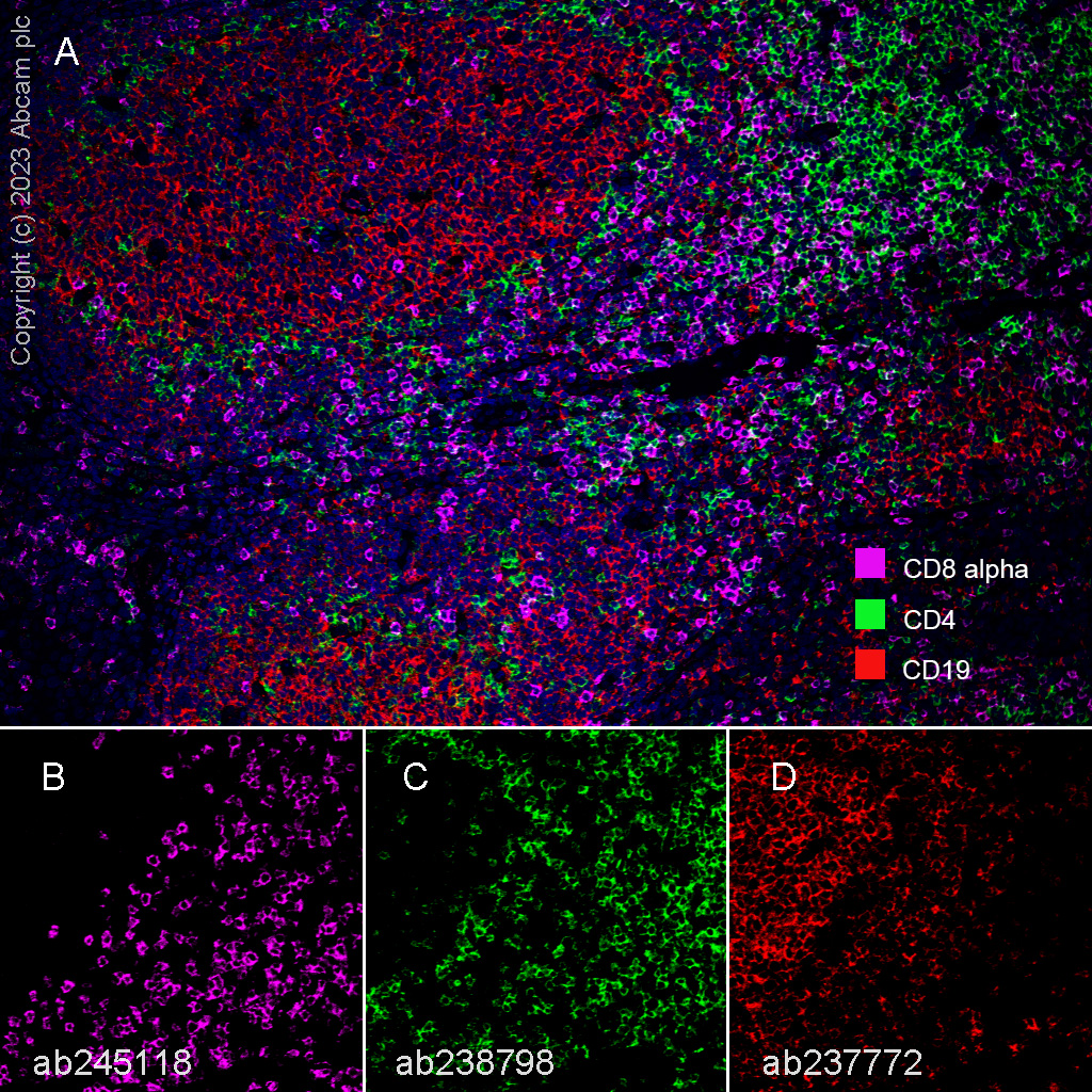 Multiplex immunohistochemistry - Anti-CD8 alpha antibody [EPR22483-288] - BSA and Azide free (AB245830), expandable thumbnail