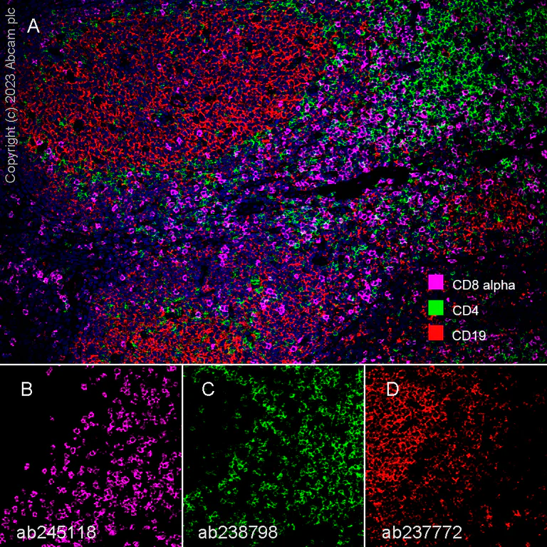 Multiplex immunohistochemistry - Anti-CD8 alpha antibody [EPR22483-288] - BSA and Azide free (AB245830)
