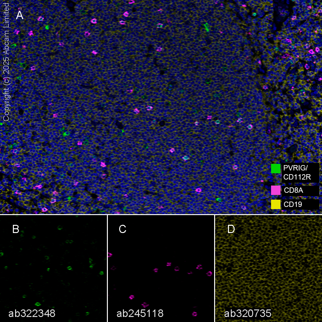 Multiplex immunohistochemistry - Anti-CD8 alpha antibody [EPR22483-288] - BSA and Azide free (ab245830), expandable thumbnail