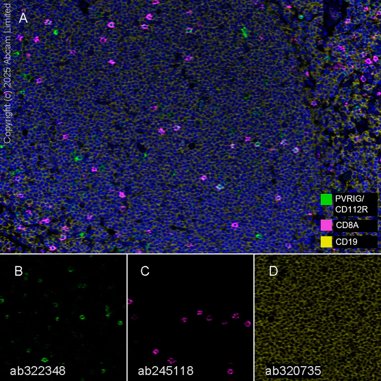 Multiplex immunohistochemistry - Anti-CD8 alpha antibody [EPR22483-288] - BSA and Azide free (AB245830)