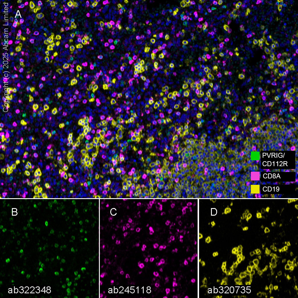 Multiplex immunohistochemistry - Anti-CD8 alpha antibody [EPR22483-288] - BSA and Azide free (ab245830), expandable thumbnail