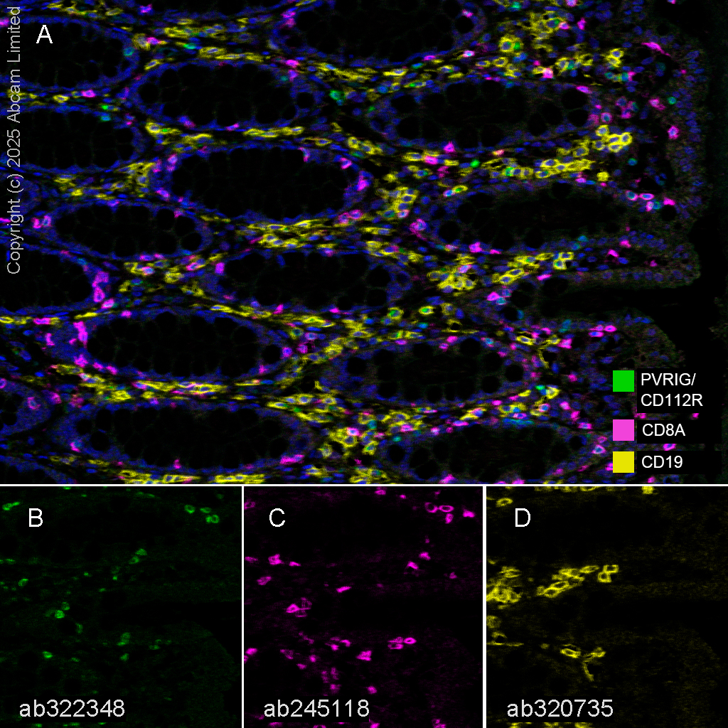 Multiplex immunohistochemistry - Anti-CD8 alpha antibody [EPR22483-288] - BSA and Azide free (ab245830), expandable thumbnail