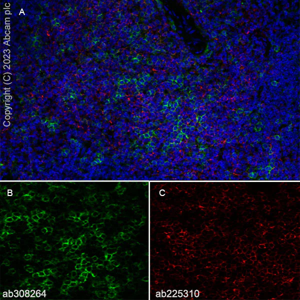 Immunohistochemistry (Frozen sections) - Anti-CD8 alpha antibody [KT15] (AB308264)
