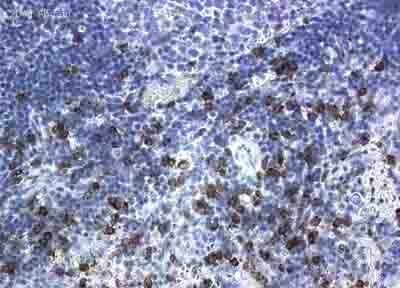 Immunohistochemistry (Formalin/PFA-fixed paraffin-embedded sections) - Anti-CD8 alpha antibody [OX-8] (AB33786), expandable thumbnail