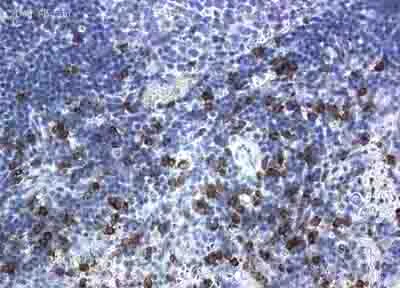 Immunohistochemistry (Formalin/PFA-fixed paraffin-embedded sections) - Anti-CD8 alpha antibody [OX-8] (AB33786)